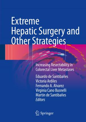 Cover of the book Extreme Hepatic Surgery and Other Strategies by Thalia Valeta