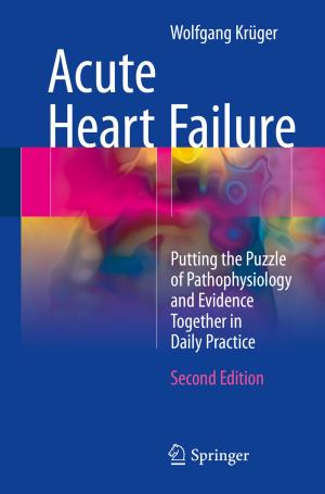 bigCover of the book Acute Heart Failure by 