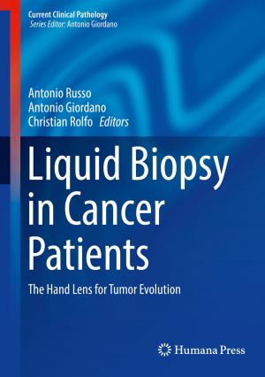 Cover of the book Liquid Biopsy in Cancer Patients by Antonio Laganà, Gregory A. Parker