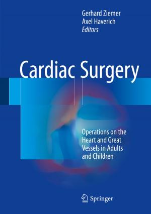 Cover of the book Cardiac Surgery by Markus Kaltenborn
