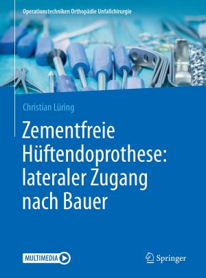 Cover of the book Zementfreie Hüftendoprothese: lateraler Zugang nach Bauer by Hannu Christian Wichterich