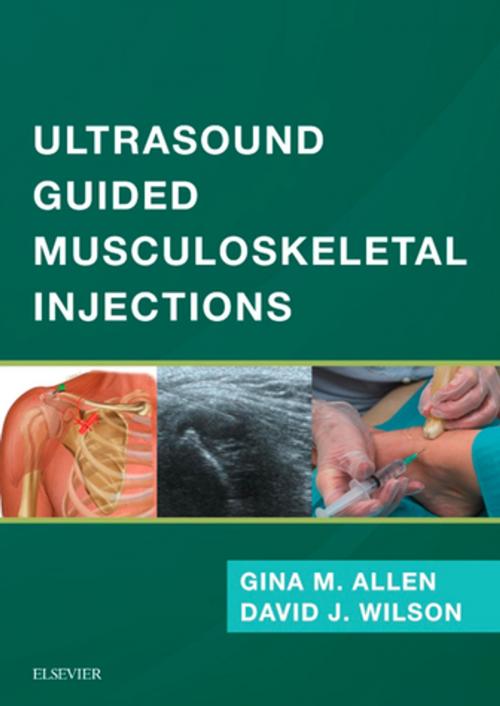Cover of the book Ultrasound Guided Musculoskeletal Injections E-Book by David John Wilson, MBBS, BSc, MFSEM, FRCP, FRCR, Gina M Allen, BM, DCH, MRCGP, MRCP, FRCR, MFSEM, DipESSR, MScSEM, Elsevier Health Sciences