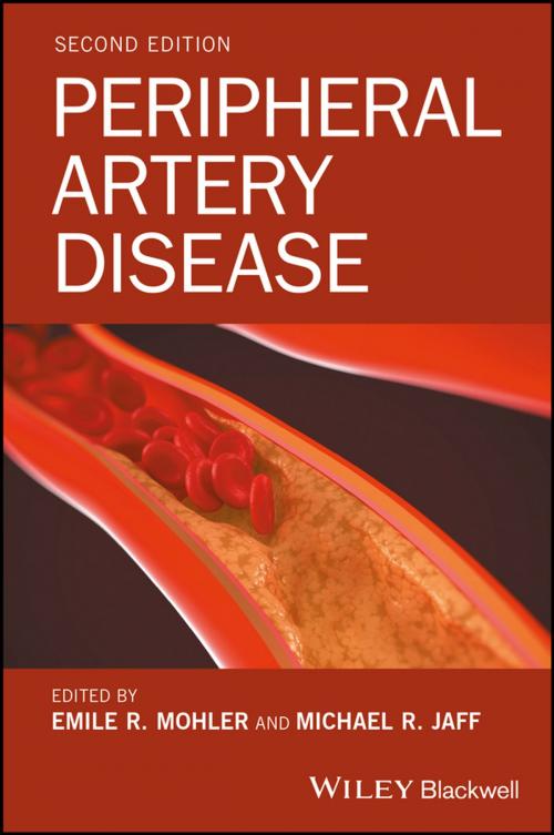Cover of the book Peripheral Artery Disease by , Wiley