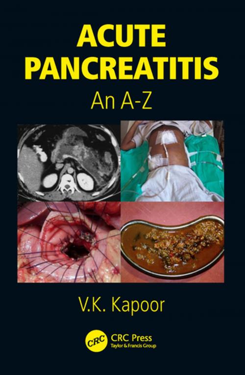 Cover of the book Acute Pancreatitis by V.K. Kapoor, CRC Press