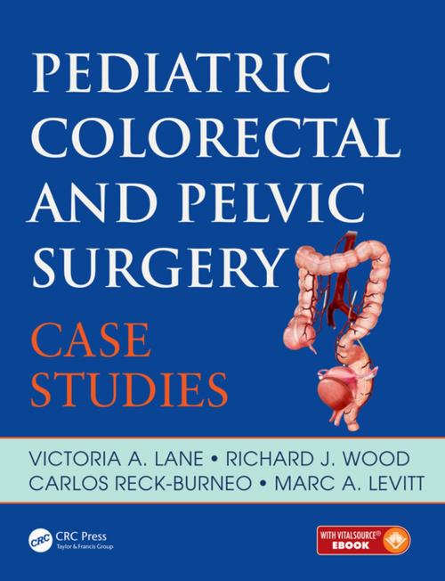 Cover of the book Pediatric Colorectal and Pelvic Surgery by Victoria A. Lane, Richard J. Wood, Carlos Reck, Marc A. Levitt, CRC Press