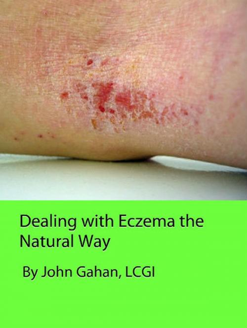 Cover of the book Dealing with Eczema the Natural Way by John Gahan, LCGI, Sepharial