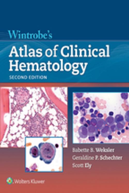 Cover of the book Wintrobe's Atlas of Clinical Hematology by Babette Weksler, Wolters Kluwer Health