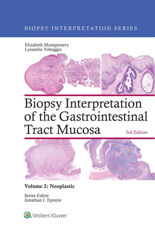 Cover of the book Biopsy Interpretation of the Gastrointestinal Tract Mucosa: Volume 2: Neoplastic by Elizabeth A. Montgomery, Lysandra Voltaggio, Wolters Kluwer Health