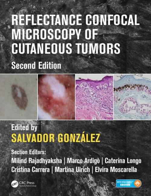 Cover of the book Reflectance Confocal Microscopy of Cutaneous Tumors by , CRC Press