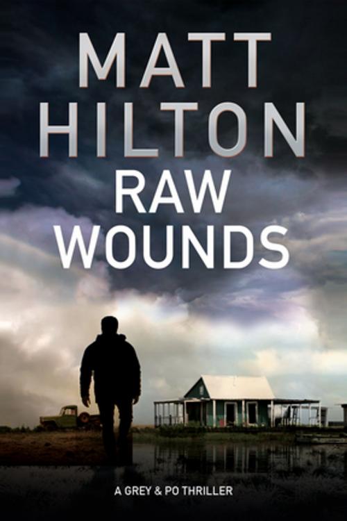 Cover of the book Raw Wounds by Matt Hilton, Severn House Publishers