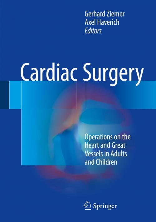 Cover of the book Cardiac Surgery by , Springer Berlin Heidelberg