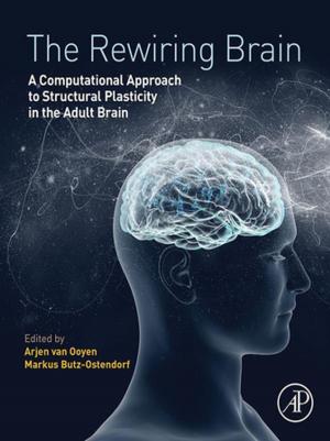 Cover of the book The Rewiring Brain by Antony Joseph
