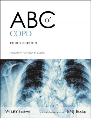 Cover of the book ABC of COPD by Manoj Gupta, Sharon Nai Mui Ling