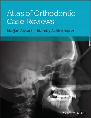 Cover of the book Atlas of Orthodontic Case Reviews by Xu Ma, Gonzalo R. Arce