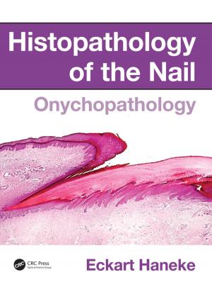 Cover of the book Histopathology of the Nail by CRC Press