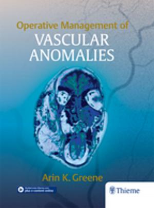 Cover of the book Operative Management of Vascular Anomalies by Mario Sanna, Alessandra Russo, Antonio Caruso