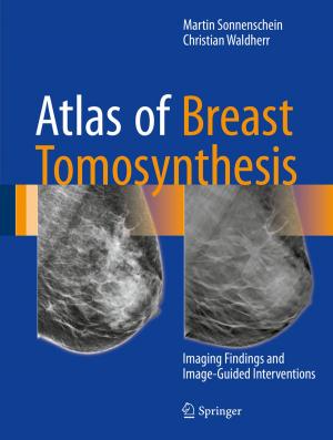 Cover of the book Atlas of Breast Tomosynthesis by Yoshihiro Yamamoto