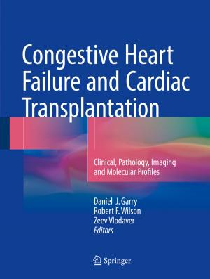 Cover of the book Congestive Heart Failure and Cardiac Transplantation by Marilene Lorizio, Annamaria Stramaglia, Antonia Rosa Gurrieri