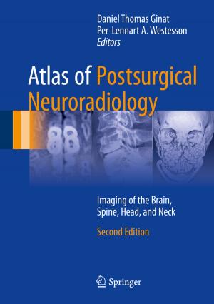 Cover of the book Atlas of Postsurgical Neuroradiology by Per Davidsson