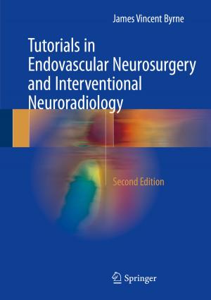 Cover of the book Tutorials in Endovascular Neurosurgery and Interventional Neuroradiology by Richard Edlin, Christopher McCabe, Claire Hulme, Peter Hall, Judy Wright