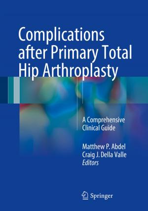 Cover of the book Complications after Primary Total Hip Arthroplasty by Bo Göransson, Judith Sutz, Rodrigo Arocena