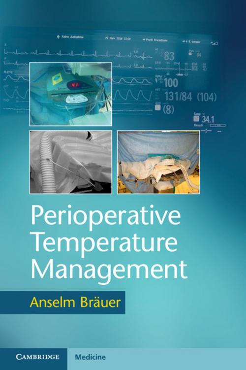 Cover of the book Perioperative Temperature Management by Anselm Bräuer, Cambridge University Press