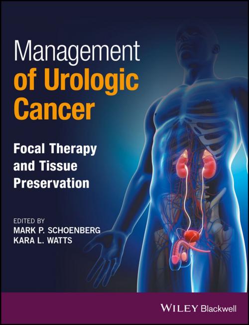 Cover of the book Management of Urologic Cancer by , Wiley