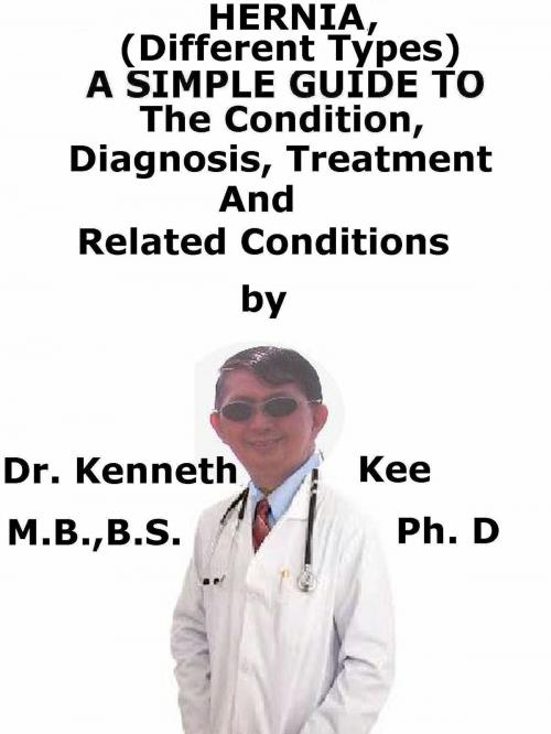 Cover of the book Hernia, (Different Types) A Simple Guide To The Condition, Diagnosis, Treatment And Related Conditions by Kenneth Kee, Kenneth Kee