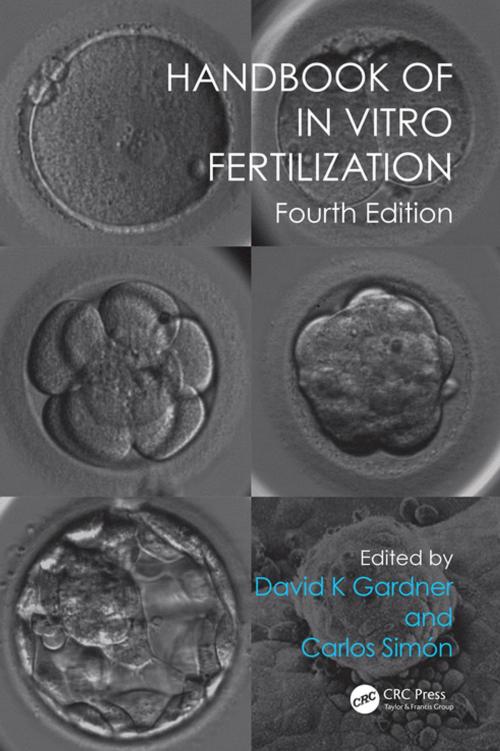 Cover of the book Handbook of In Vitro Fertilization by , CRC Press