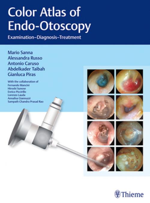 Cover of the book Color Atlas of Endo-Otoscopy by Mario Sanna, Alessandra Russo, Antonio Caruso, Thieme