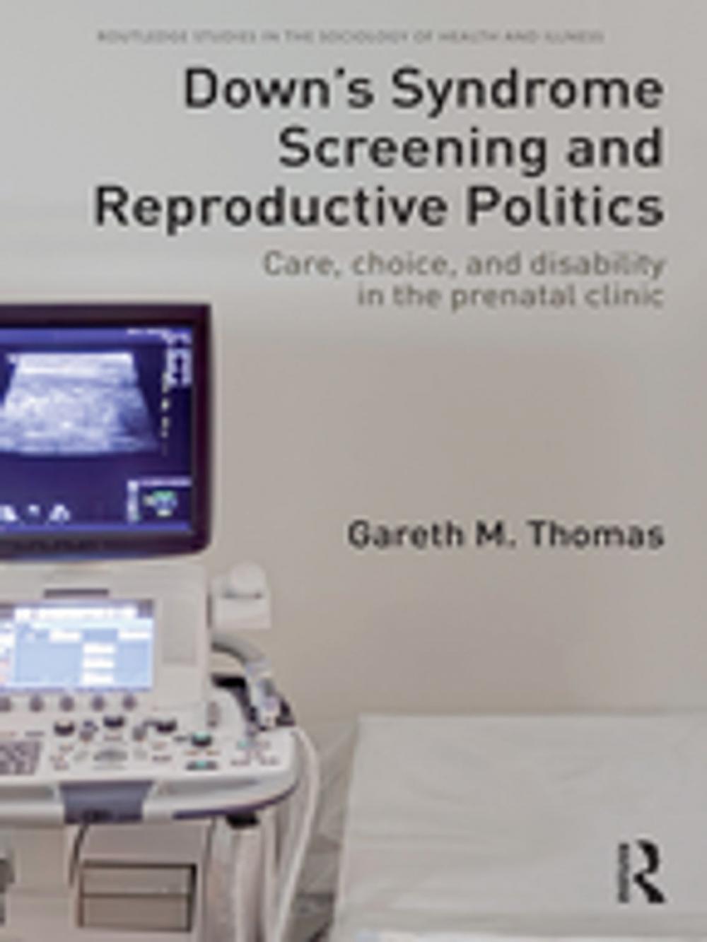 Big bigCover of Down's Syndrome Screening and Reproductive Politics