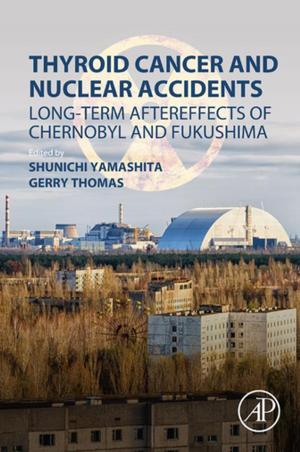 Cover of the book Thyroid Cancer and Nuclear Accidents by J. D. Irwin