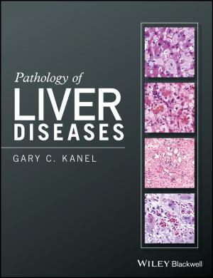bigCover of the book Pathology of Liver Diseases by 