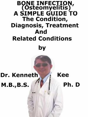 Cover of Bone Infection, (Osteomyelitis) A Simple Guide To The Condition, Diagnosis, Treatment And Related Conditions