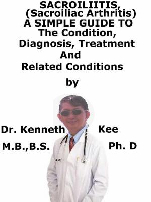 Book cover of Sacroliitis (Sacroiliac Arthritis), A Simple Guide To The Condition, Diagnosis, Treatment And Related Conditions
