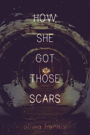 Book cover of How She Got Those Scars