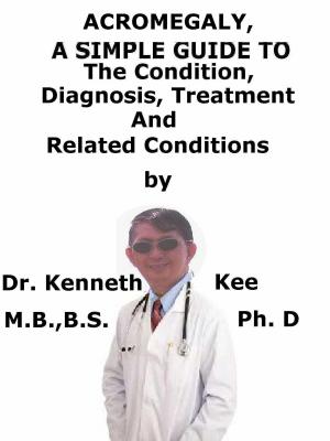 Book cover of Acromegaly, A Simple Guide To The Condition, Diagnosis, Treatment And Related Conditions