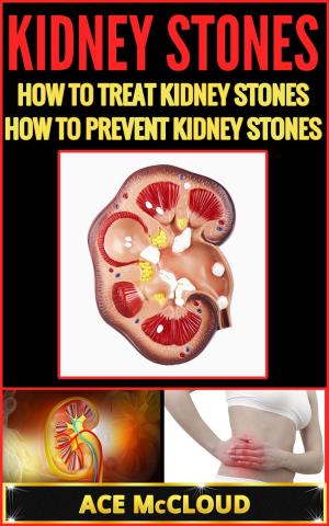 Cover of the book Kidney Stones: How To Treat Kidney Stones: How To Prevent Kidney Stones by Ace McCloud