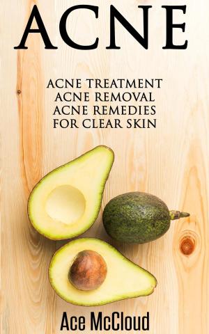 Book cover of Acne: Acne Treatment: Acne Removal: Acne Remedies For Clear Skin