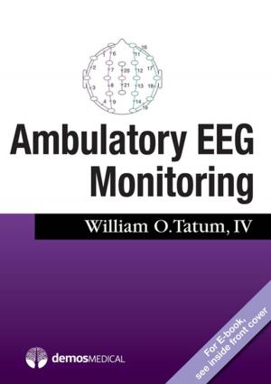 Cover of the book Ambulatory EEG by Eric Rossen, PhD, Diana Joyce-Beaulieu, PhD, NCSP