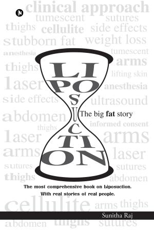 Cover of the book Liposuction The big fat story by KALYANKUMAR S. HATTI.