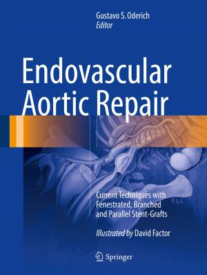 Cover of the book Endovascular Aortic Repair by Ling Hou, Anthony N. Michel, Derong Liu