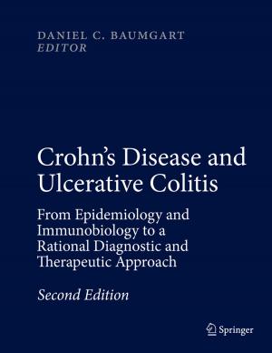 Cover of the book Crohn's Disease and Ulcerative Colitis by Miao Pan, Ming Li, Pan Li, Yuguang Fang