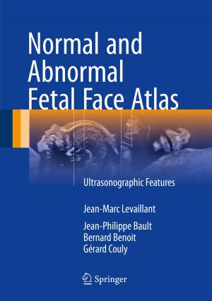Cover of the book Normal and Abnormal Fetal Face Atlas by Nicholas P. Sargen
