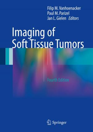 Cover of the book Imaging of Soft Tissue Tumors by Ilya Gertsbakh, Yoseph Shpungin, Radislav Vaisman