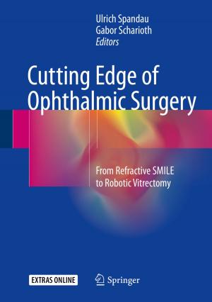 Cover of the book Cutting Edge of Ophthalmic Surgery by Carlile Lavor, Leo Liberti, Weldon A. Lodwick, Tiago Mendonça da Costa