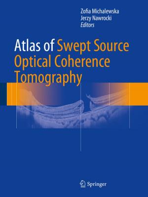 Cover of the book Atlas of Swept Source Optical Coherence Tomography by Jens Pfafferott, Doreen E. Kalz