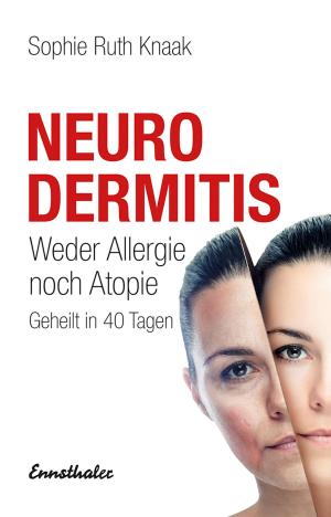 Cover of the book Neurodermitis by Christa Kössner