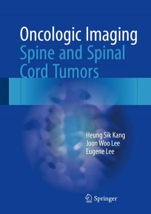 Cover of the book Oncologic Imaging: Spine and Spinal Cord Tumors by Dong Shen, Xuefang Li