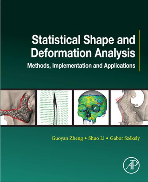 Cover of the book Statistical Shape and Deformation Analysis by Guoyan Zheng, Shuo Li, Gabor Szekely, Elsevier Science